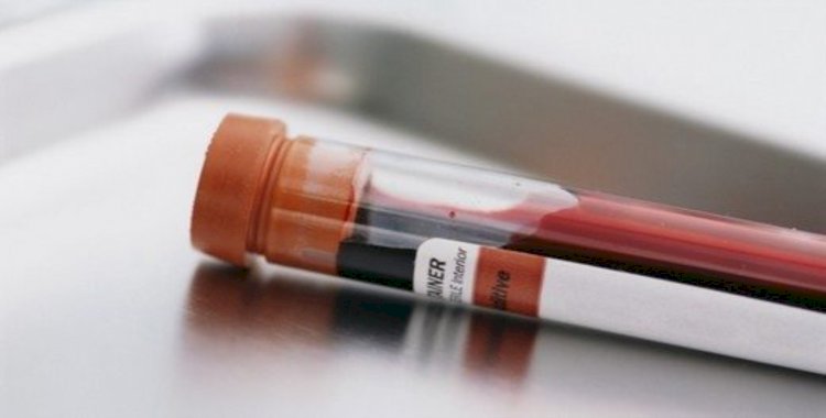 Bazı kanser türlerini belirtiler görülmeden tespit eden kan testi geliştirildi