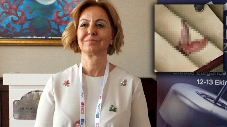 Prof. Esin Davutoğlu Şenol, aşı karşıtlarının hedefindeydi: Kapısına dana dili atıp tehdit ettiler
