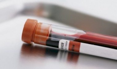 Bazı kanser türlerini belirtiler görülmeden tespit eden kan testi geliştirildi