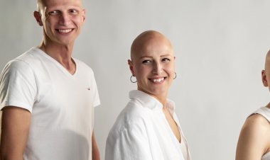 “ALOPESİ” FARKINDALIĞINA “TOKAT GİBİ GERÇEKLER”