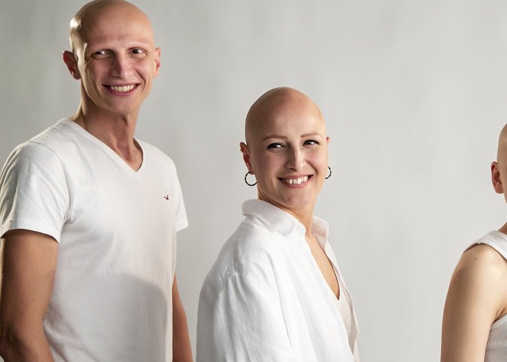 “ALOPESİ” FARKINDALIĞINA “TOKAT GİBİ GERÇEKLER”