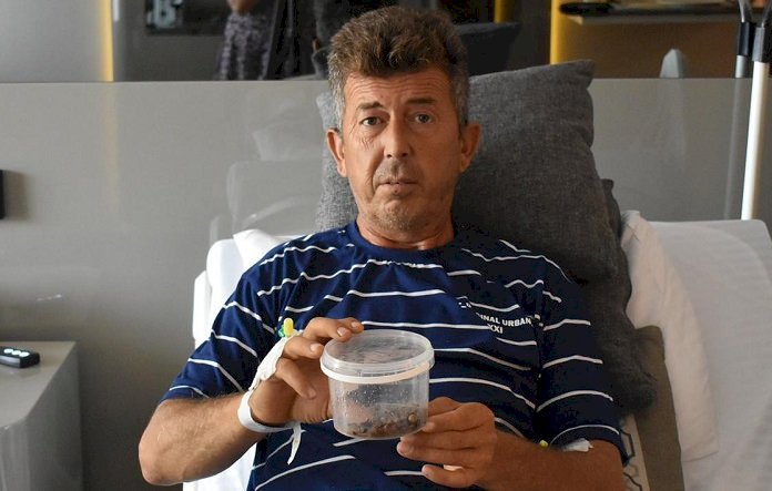 Tek Operasyonda Tüm Böbreğini Dolduran Taşlardan Kurtuldu!