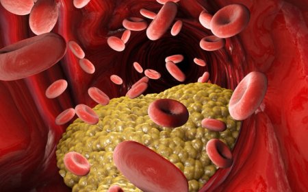 Trigliserid Nedir?