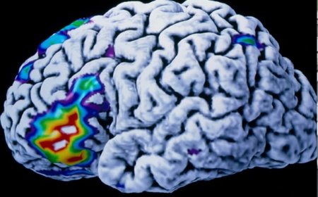 Beyin implantı düşünceleri anında konuşmaya çeviriyor