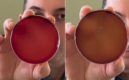 Hazır sularda hijyen testi: 7 marka laboratuvarda incelendi